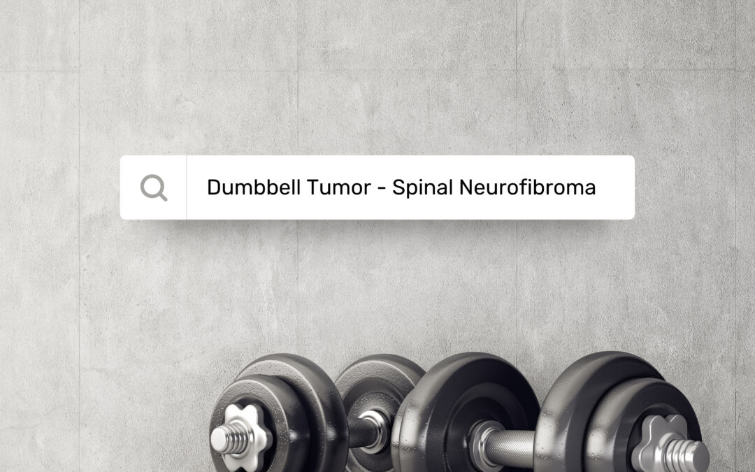 Spine & Dumbbell