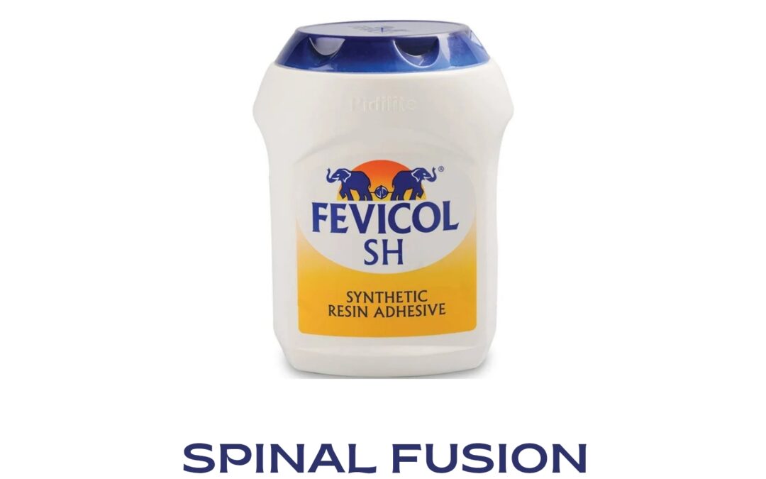 Spine & Glue