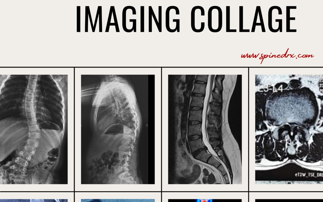 Spine & Imaging 