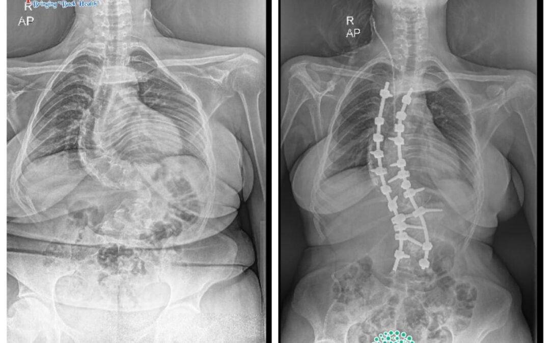 From Fear to Walking: A Remarkable Recovery